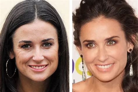 Did Demi Moore Have Plastic Surgery? Exploring the Intricacies of Celebrity Transformations